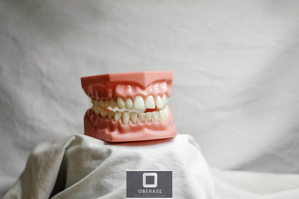 teeth, dental, dental model