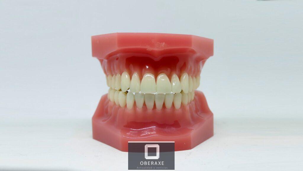 A Dental Model on a White Surface